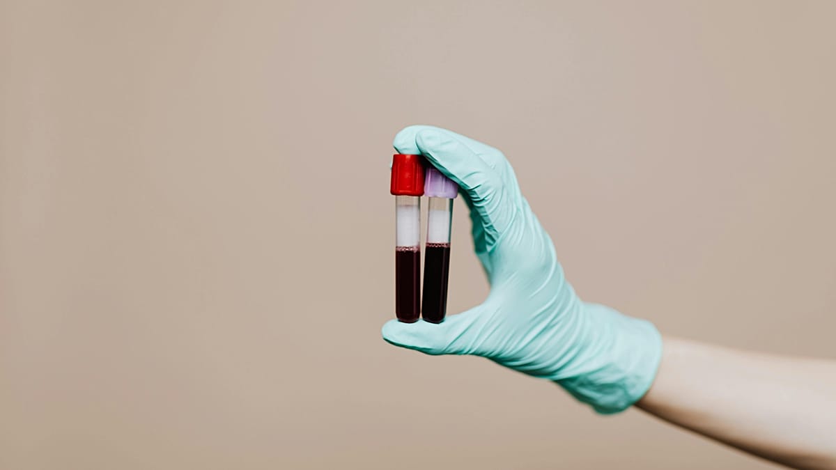 Un simple análisis de sangre podría prever quién vivirá más