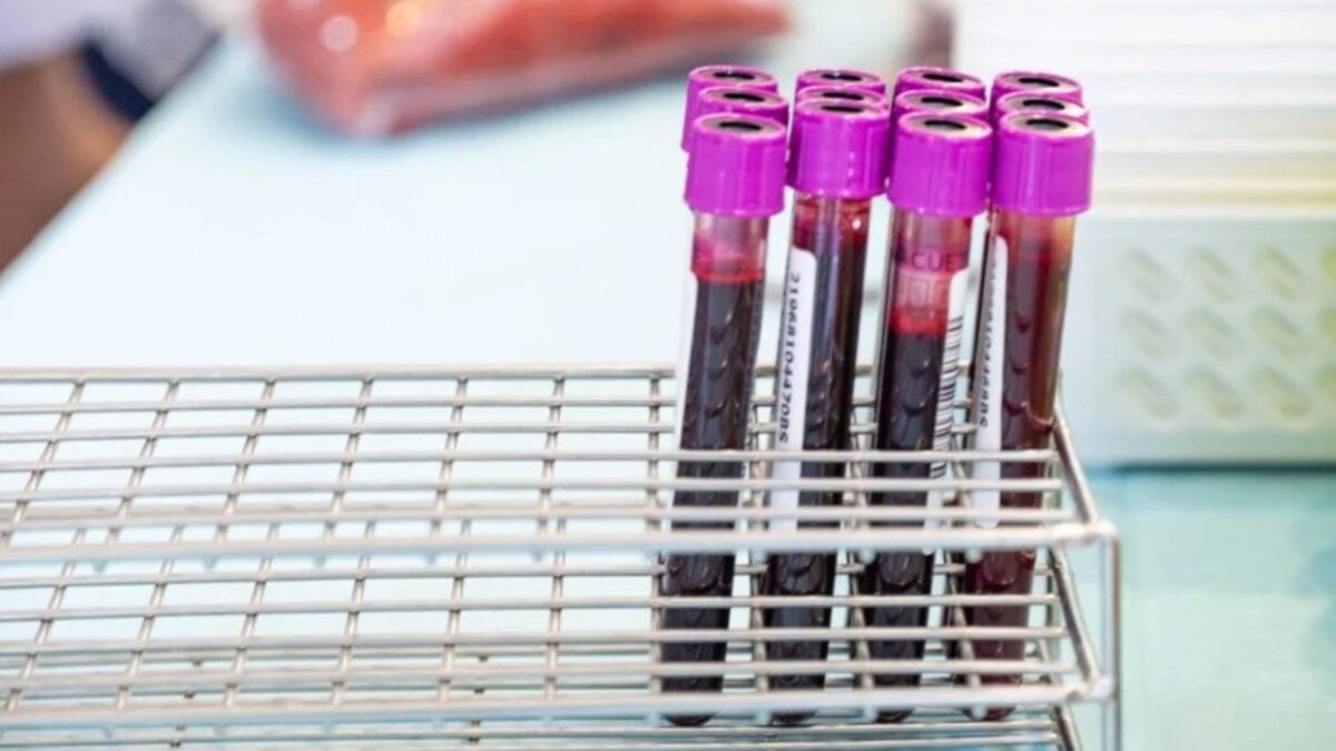 Un simple análisis de sangre podría decirte eventualmente cuándo llegaría el mal de Alzheimer